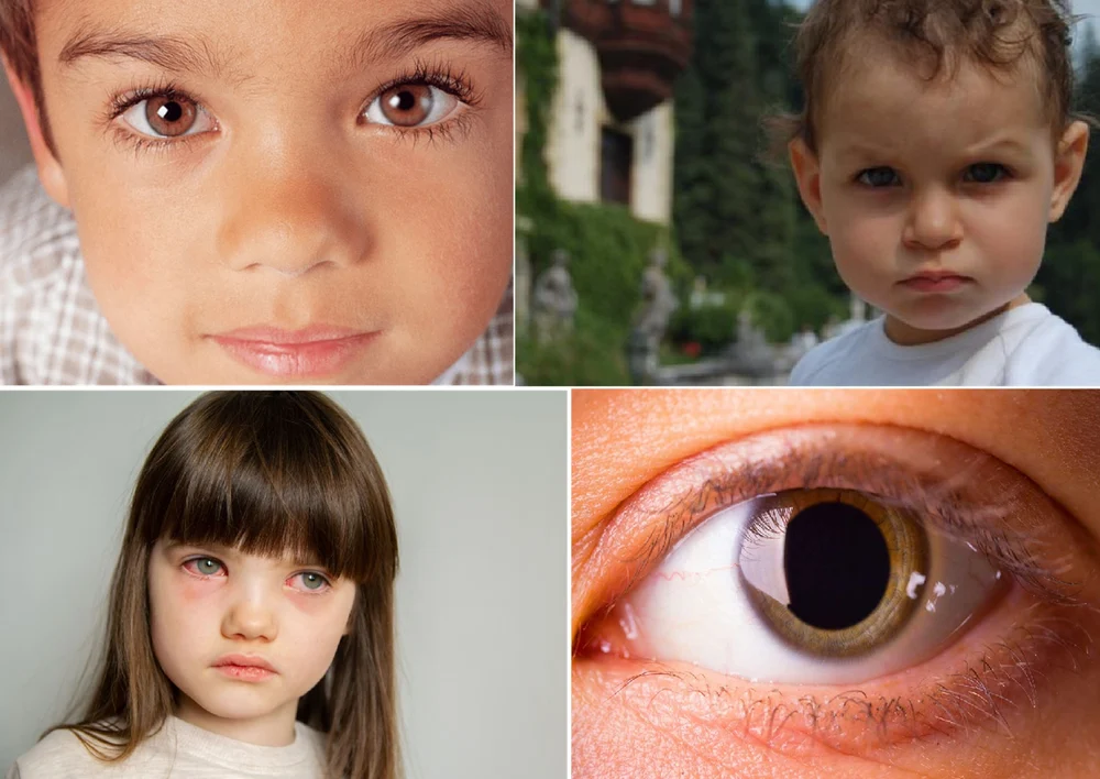 Privirea copilului tău îți poate spune mai multe decât crezi: ce boli grave poți depista din ochi