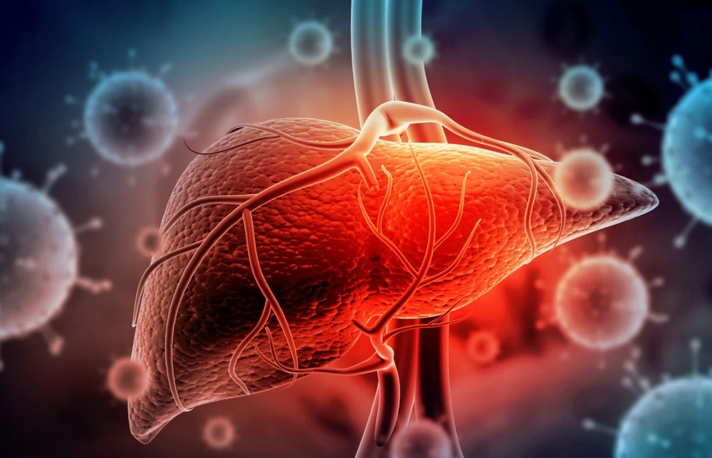 Alertă în Dolj: DSP confirmă 7 focare de hepatită A. Medicii au depistat aproximativ 150 de cazuri