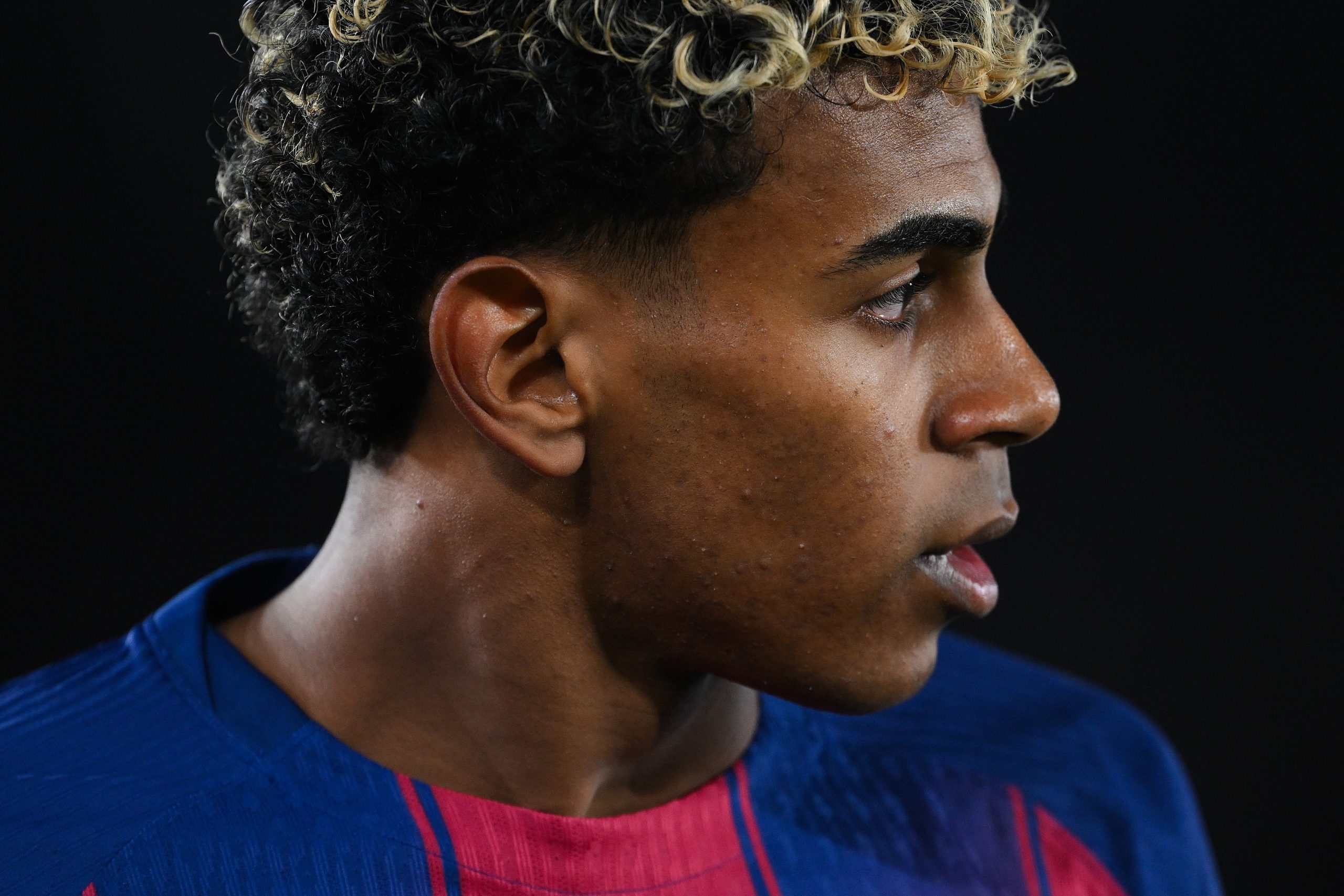 Girona -0, ACUM, DGS 2. Penalty ratat de Lamine Yamal