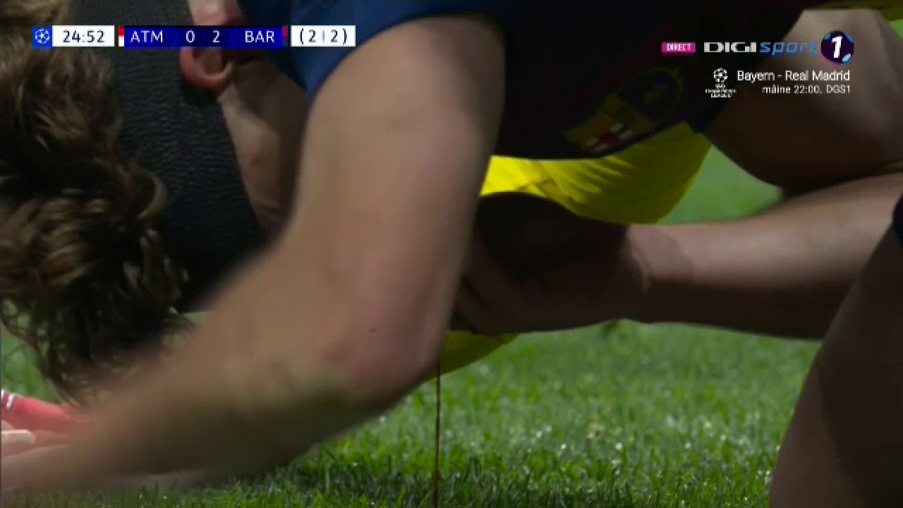 Ce accidentare horror în Atletico